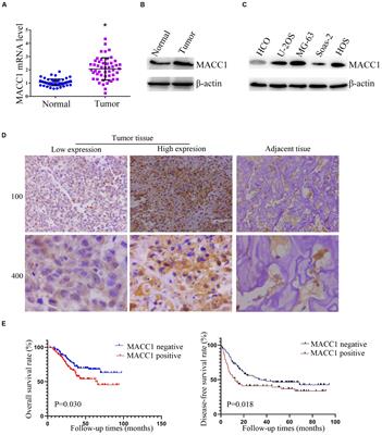 MACC1 Contributes to the Development of Osteosarcoma Through Regulation of the HGF/c-Met Pathway and Microtubule Stability